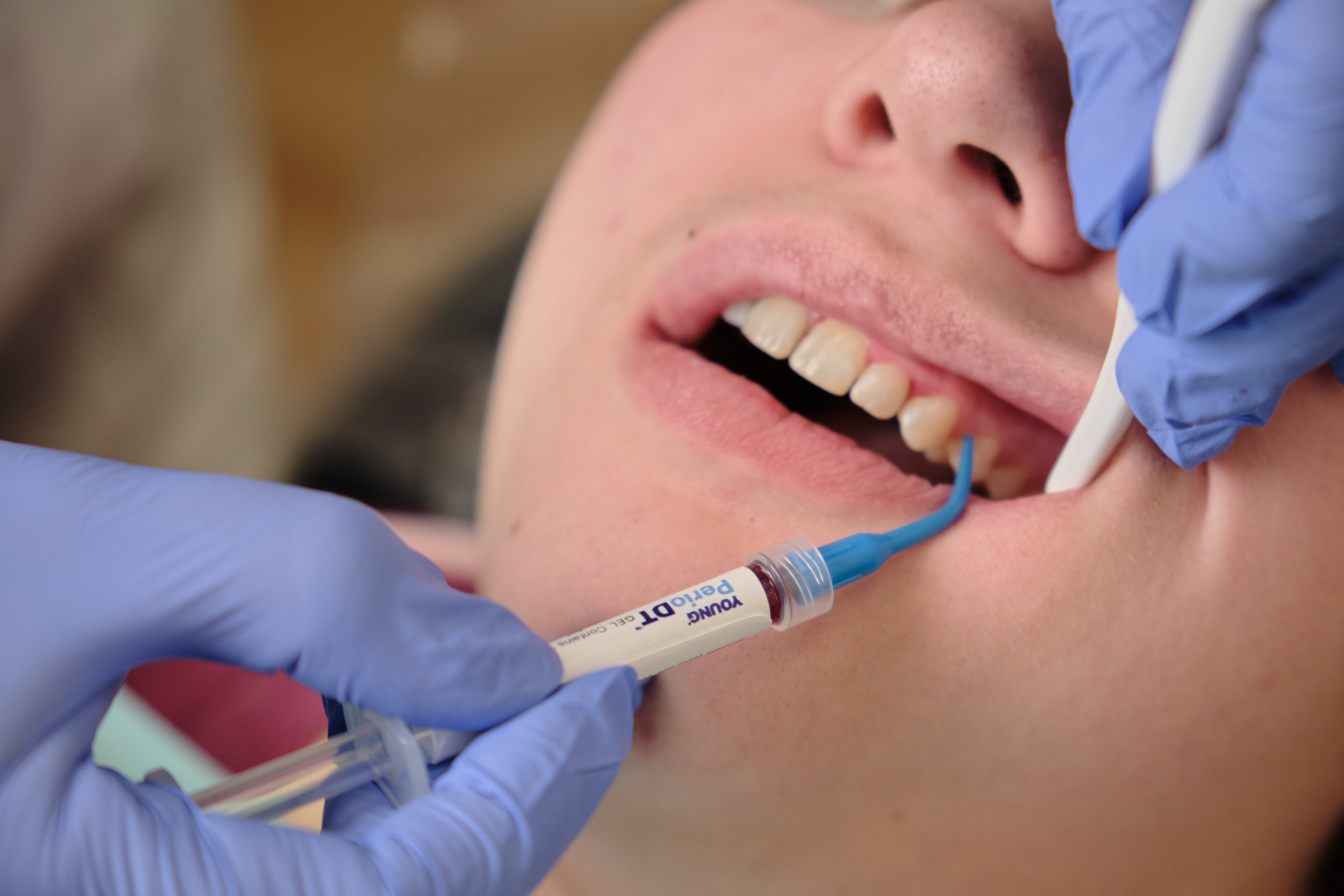 Desiccation Technology: A Valuable Asset in Dentistry